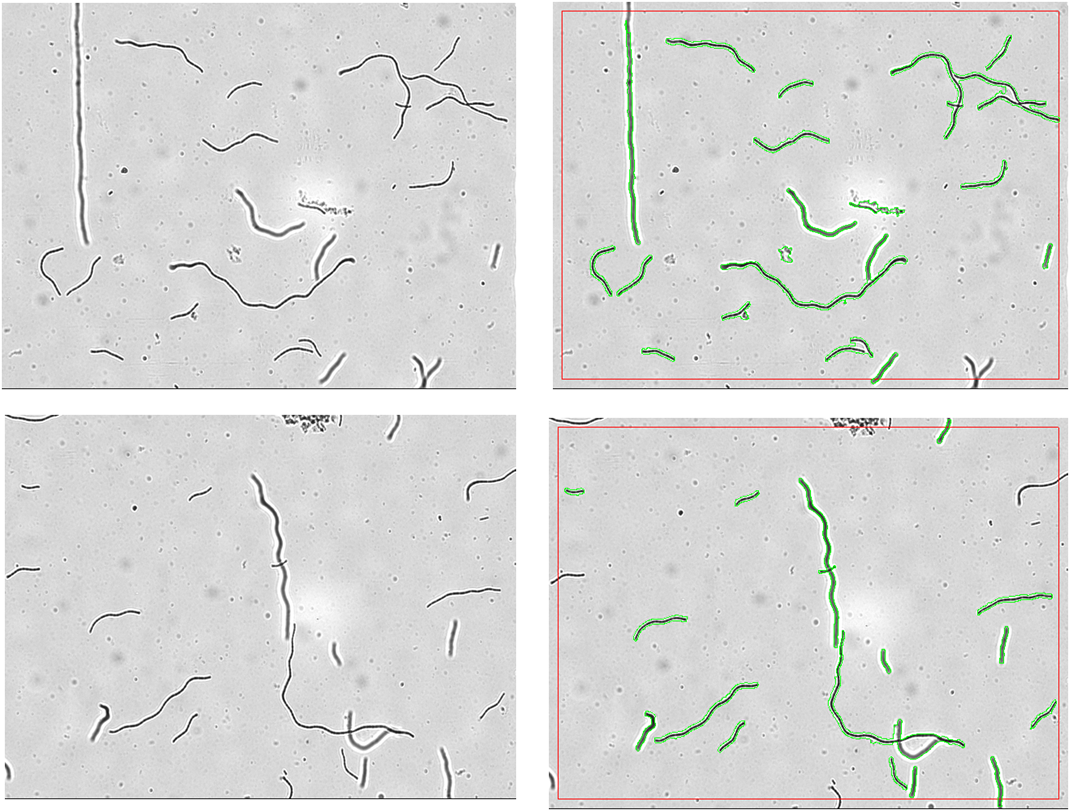 X2-Algae filamentous BF counting.png X2-Algae filamentous BF counting.png